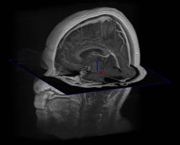 tl_files/mrc_downloads/Bilder von Pruefungen/MR_Head_Volume_with_Slices_in_separate_Windows.jpg