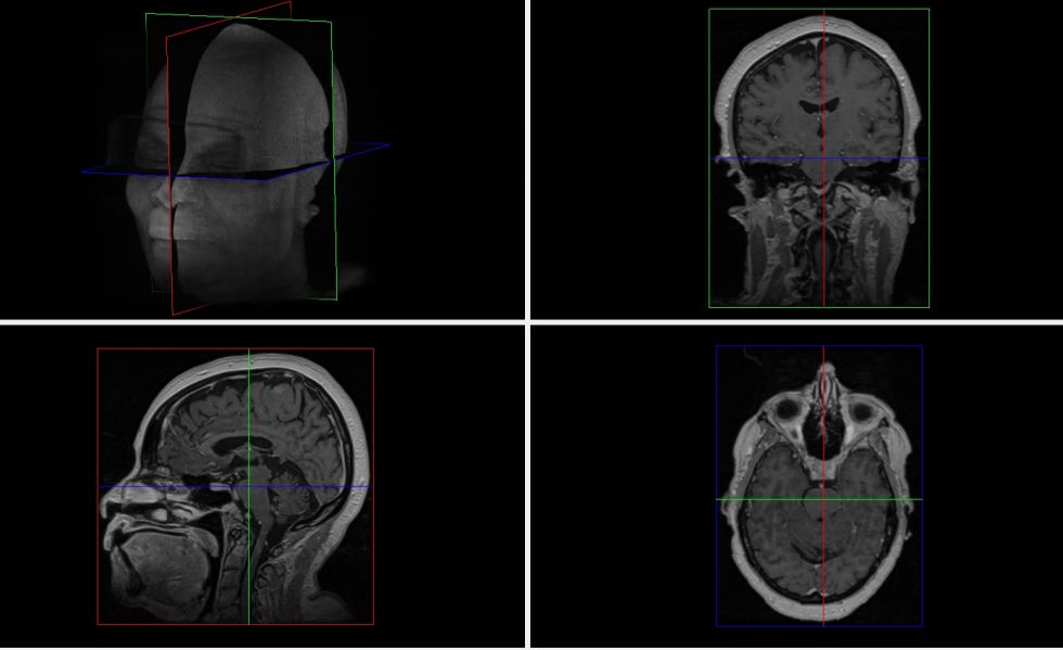 tl_files/mrc_downloads/Bilder von Pruefungen/MR_Head_Volume_with_Slice.jpg